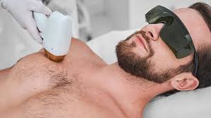 Laser Hair Reduction