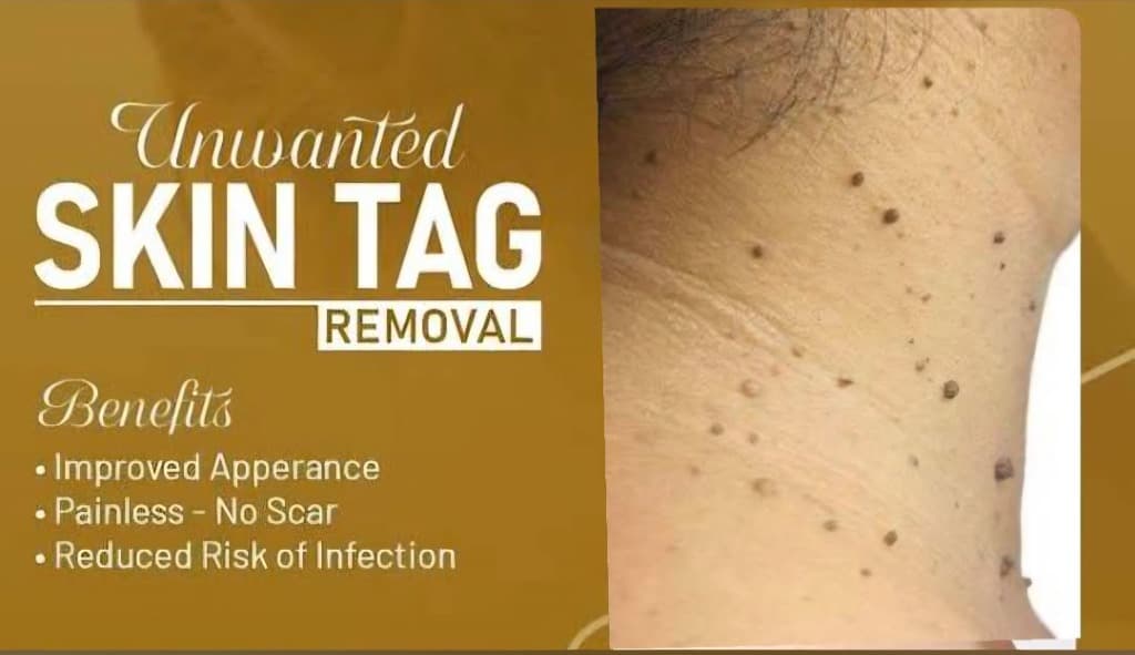 Treatment Result