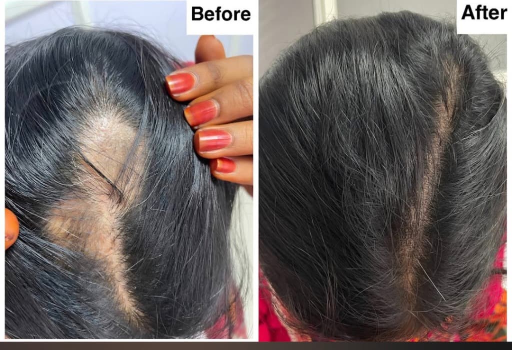 Treatment Result
